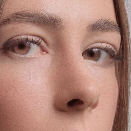 Before Brow / Forehead Lift